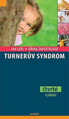 Turnerův syndrom