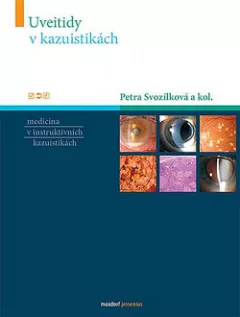 Uveitidy v kazuistikách